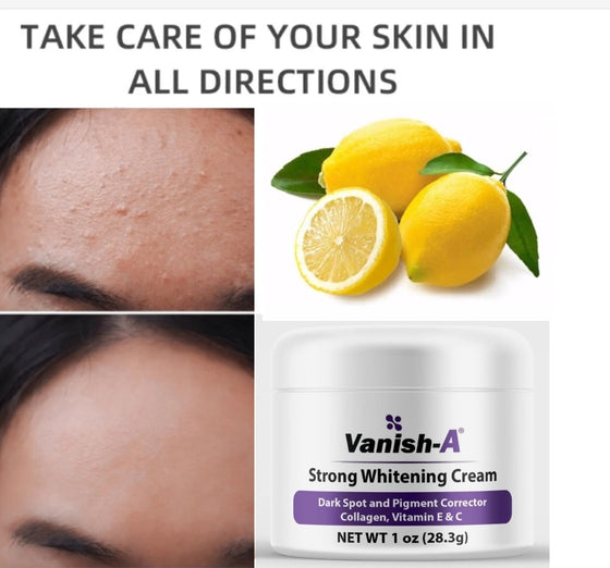 Vanish-A Strong Brightening Cream 4 oz - Good Brands USA