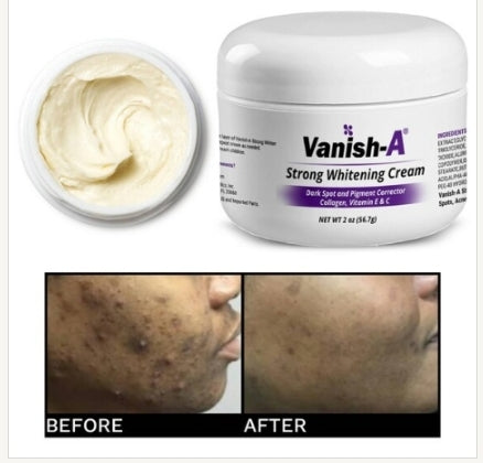 Vanish-A Strong Skin Brightening Cream- 1oz, 20z, 4oz - Good Brands USA