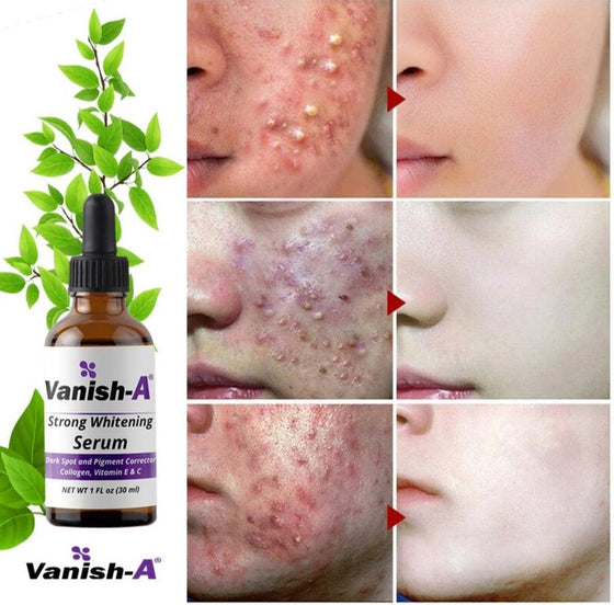 Vanish-A whitening serum - GoodBrands USA 