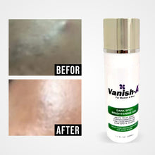  VANISH-A Skin Renewal Gel 1.7 FL oz (50ML ) - GoodBrands USA 